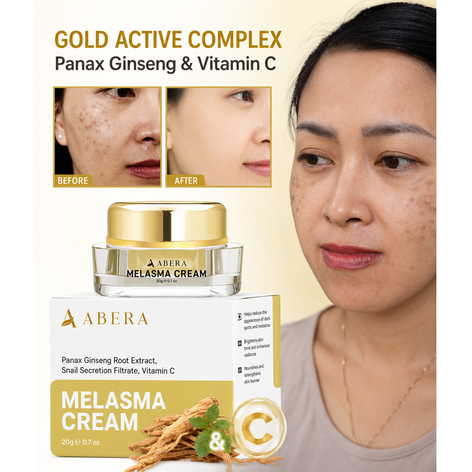 ABERA MELASMA CREAM 20G – HELPS FADE MELASMA, FRECKLES, AGE SPOTS, SMOOTHENS SKIN & PREVENTS AGING