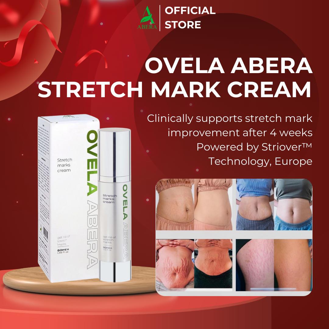 Abera Advanced Stretch Mark Cream – Prevents and Eliminates Pregnancy Stretch Marks, Weight-Gain Stretch Marks, Thigh/Armpit/Abdominal Stretch Marks, Brightens and Restores Skin (50ml)
